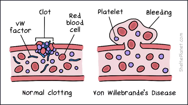 Von Willebrand Disease is caused by a lack of vWD clotting factors